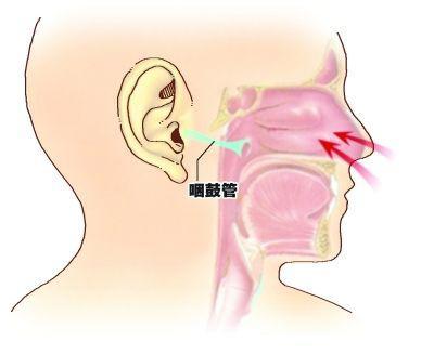 鼻窦炎需要手术吗？