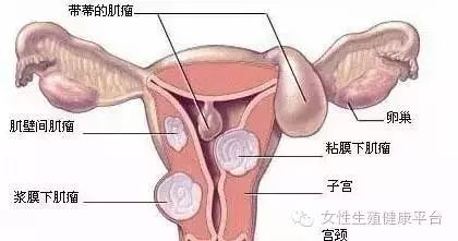 19岁女生痛经频发引发切子宫思考，原因、影响与解决方案探讨