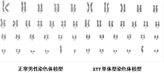 超雄是否多一条y染色体？