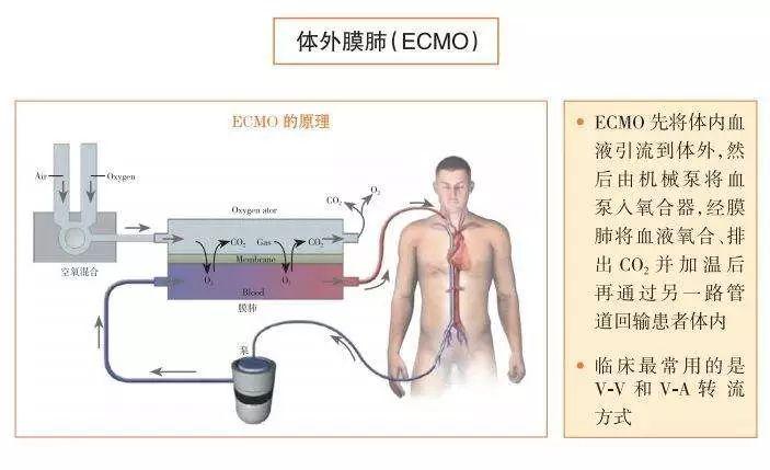 男子熬夜心脏骤停倒地，现代生活节奏的警示钟