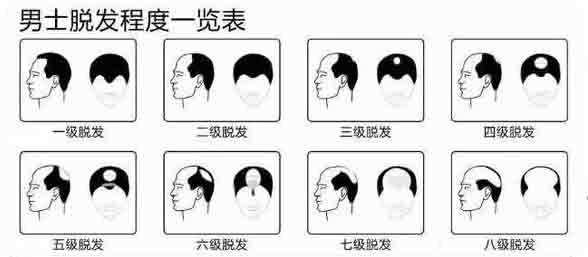 高敏感人群过年应对亲戚社交中微小恶意的巧妙策略